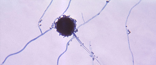Aspergillus